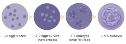 Visualisation of number of eggs that survive each stage of the egg freezing process